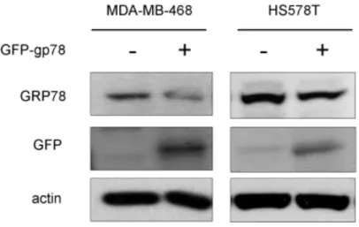 Figure 8. gp78 suppresses the expression of GRP78. The different breast cancer cells  were transfected with gp78