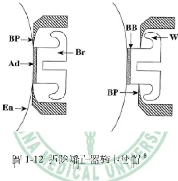 圖 1-12  拆除矯正器施力位置 8