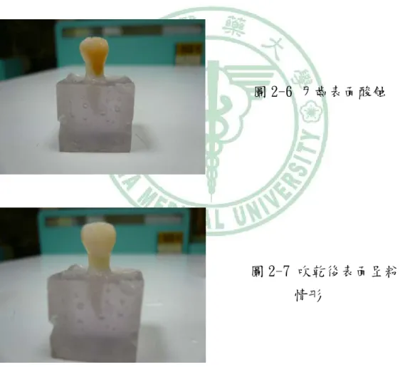 圖 2-6 牙齒表面酸蝕 