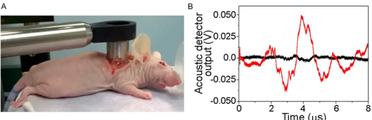 Figure  2.  A.  The  laser  pulsed  treatment  has  been  applied  locally  through  the  custom-designed endoscope with a ring- shape acoustic sensor around the optical exit window (the endoscope was coupled to the wound optically and acousti- cally throu