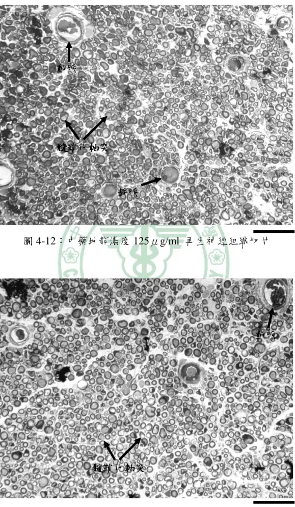 圖 4-12：中藥地龍濃度 125μg/ml 再生神經組織切片 圖 4-13：中藥地龍濃度 500μg/ml 再生神經組織切片 動脈動脈靜脈髓鞘化軸突髓鞘化軸突