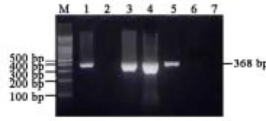 Fig. 2. The results of RT-PCR analysis of SARS-CoV are shown. The positive case  had a PCR fragment of 368-bp
