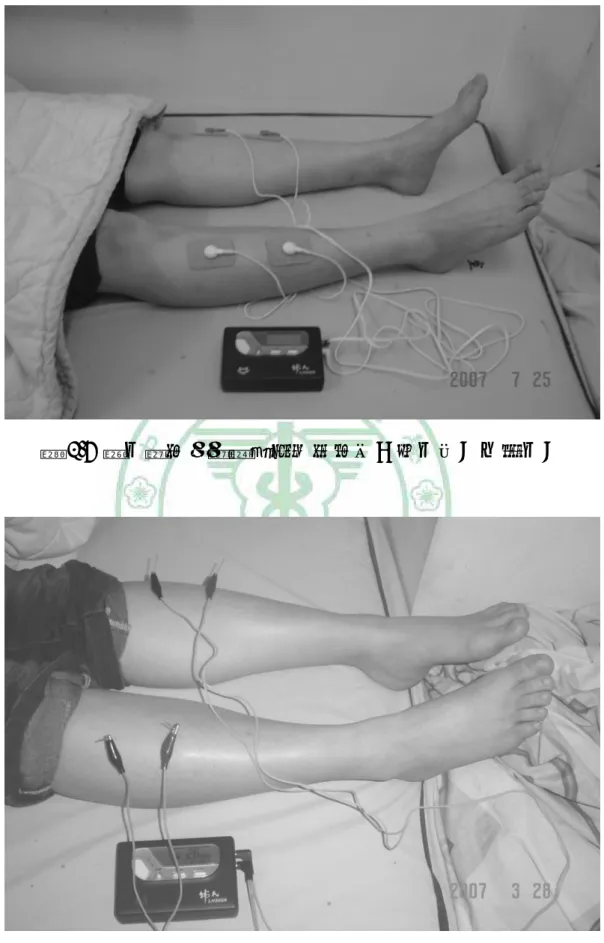 圖 3.8  經皮電刺激電極黏貼於兩側足三里穴和上巨虛穴上 