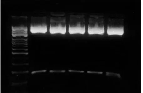 Figure 5. A representative photomicrographs of ethidium  bromide-stained gels containing plasmid DNA (3.9 kb of PCR II vector)  and PCR products (~170 bp) generated by using degenerate primers,  which extracted from transformed cell and digested by using t