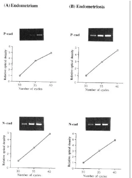 Figure 7. Validation of semiquantitative RT-PCR for P-cad or N-cad. Total  RNA isolated from eutopic endometrium (A) and endometriotic lesion (B)  were reverse transcribed