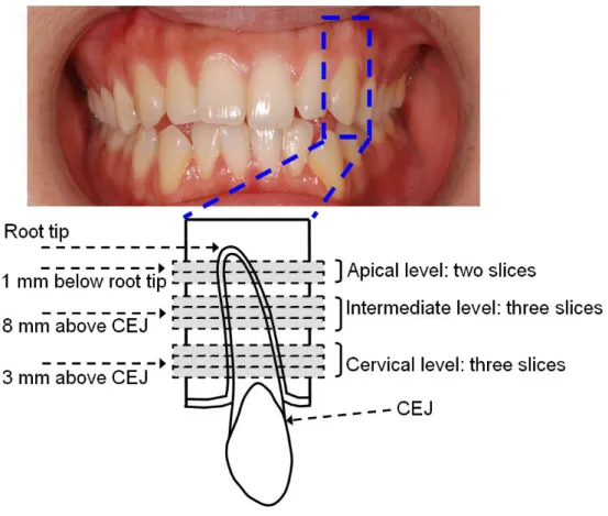 Figure 1. Schematic of the three levels at which the root of the upper-left canine and the  surrounding bone were sectioned