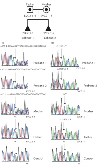Figure 11. A heterozygous deletion mutation of the 26-bp deletion encompassing the junction between intron 7 and exon 8 of the EVC2 gene (c.871-2_894del26) in proband 1, proband 2 and the mother, but not in the father, and a heterozygous nonsense mutation 