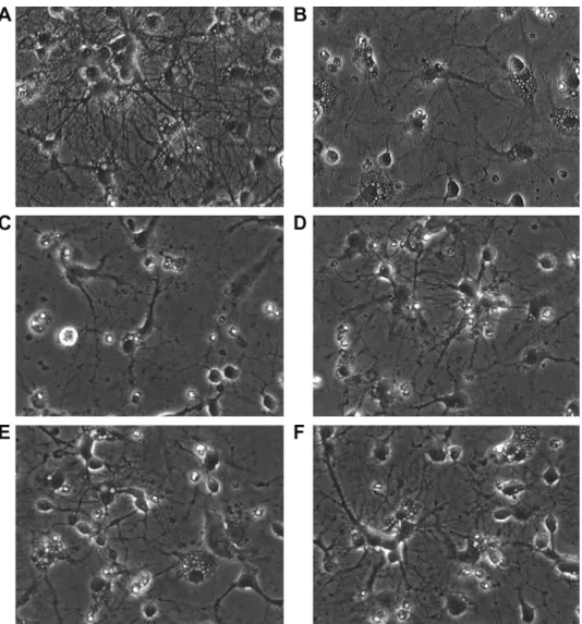 Fig. 4. Neuroprotective effect of ergothioneine (EGT) on cisplatin-induced morphological change of primary cultured rat cortical neuron cells