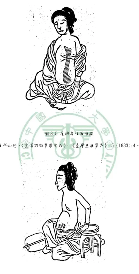 圖 3.5 廣濟奔豚湯腹證 