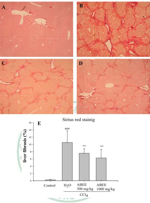 Fig. 6. Histologic analysis of liver fibrosis (Sirius red staining). 