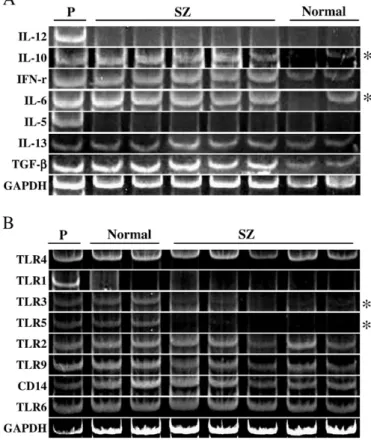 Fig. 2A. Notably, binding activity of aCL antibody was signi ﬁcantly higher in serum of schizophrenic patients as compared to those from healthy subjects (Fig