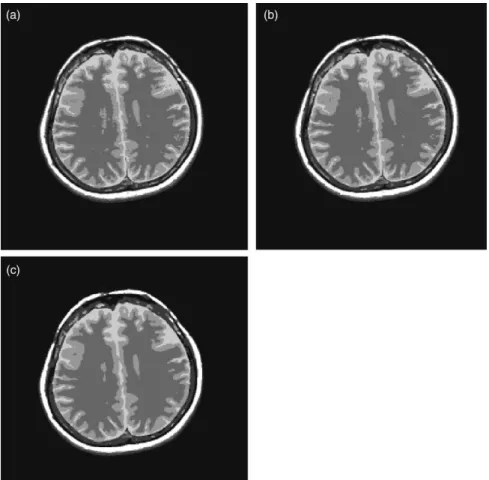 Fig. 2. Segmented images of an MRI image using (a) FCM; (b) sFCM 1,1 ; and (c) sFCM 0,2 .