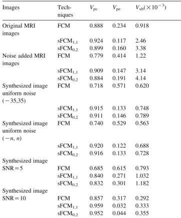 Fig. 5. Simulated (a) T1 and (b) T2 image corrupted by additive uniform noise. The gray levels are 50 (UL), 100 (UR), 150 (LL), and 200 (LR) in the T1 image and 50 (UL), 150 (UR), 100 (LL), and 200 (LR) in the T2 image