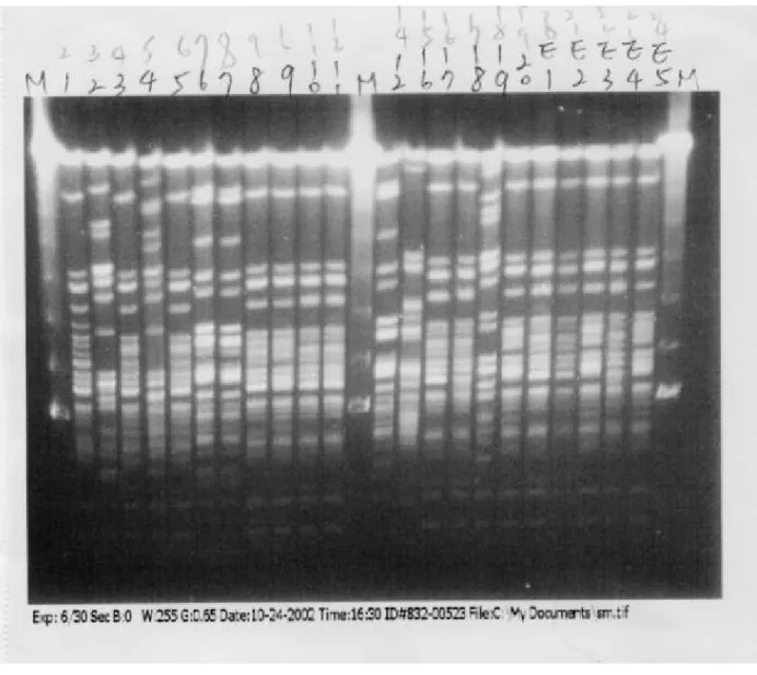 Figure 5.  PFGE fingerprints of S. marcescens isolates from APICU and  environmental screening after digestion with SpeI