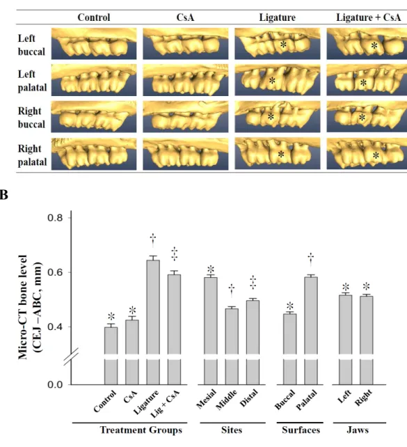 Figure 1. Effect of CsA on the ligature-induced alveolar bone loss. (A) presents the reconstructed 3D images from the computerized tomography  for maxillae viewed from the   buccal  or  palatal   direction   in    the  control,   CsA,   ligature,  and   Cs