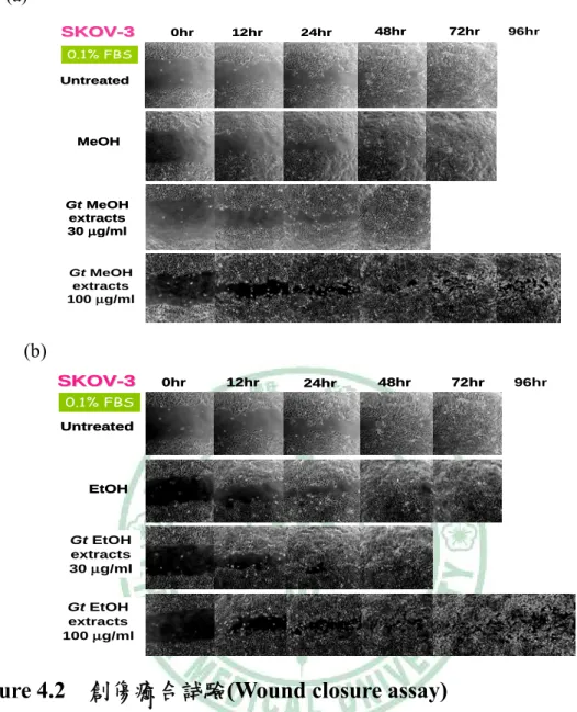 Figure 4.2    創傷癒合試驗(Wound closure assay) 