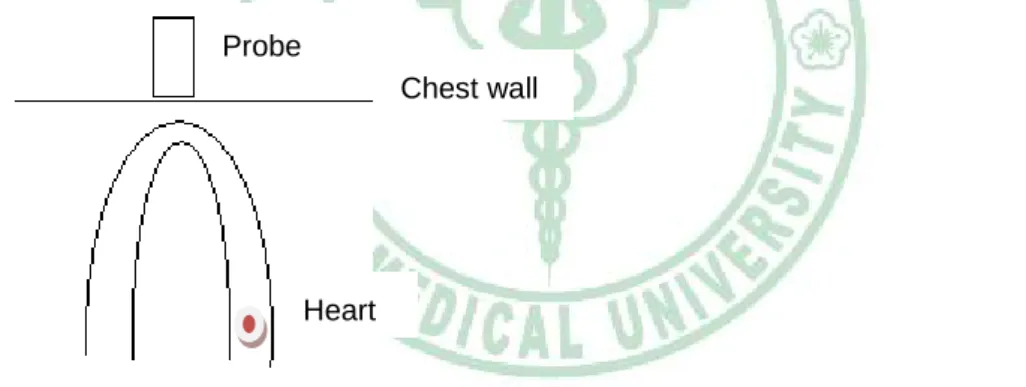 Fig 3. Tissue velocity indicates the speed at which a particular point in the  myocardium moves toward or away from the transducer on the chest wall 