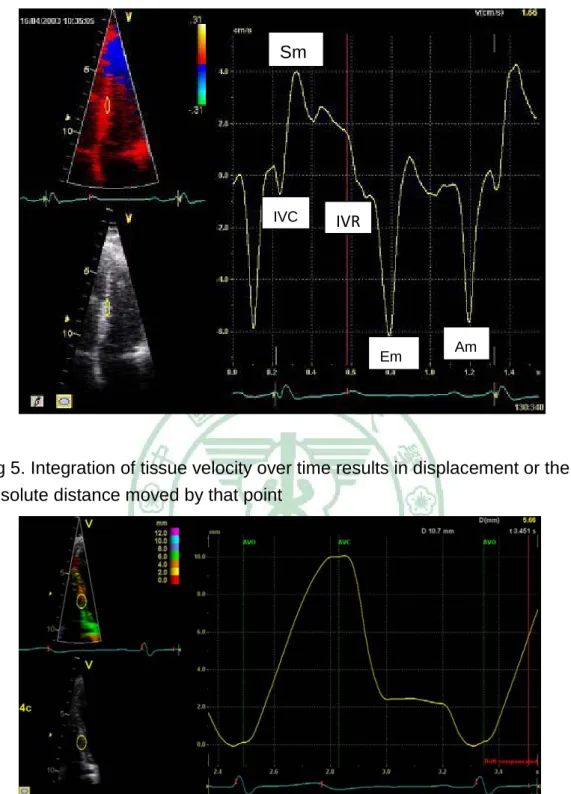 Fig 5. Integration of tissue velocity over time results in displacement or the  absolute distance moved by that point 