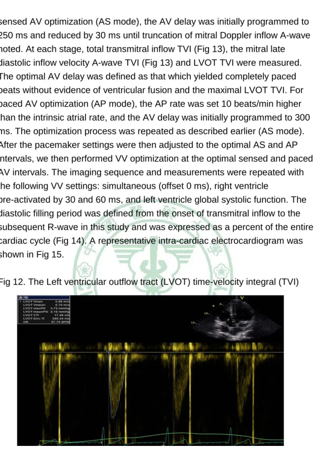 Fig 12. The Left ventricular outflow tract (LVOT) time-velocity integral (TVI) 