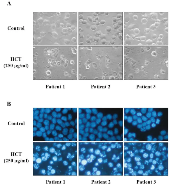 Figure 2. Effects of HCT on cell morphological changes and DNA condensation in human primary colorectal cancer cells