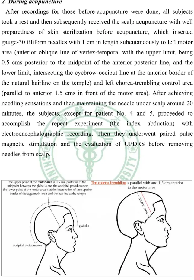Fig. 3.2. Scalp points 