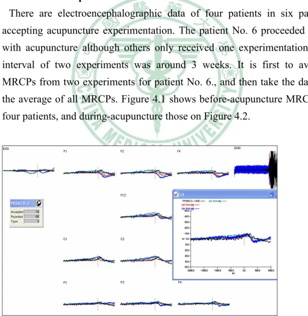 Fig. 4.1. MRCPs before acupuncture in four PD patients