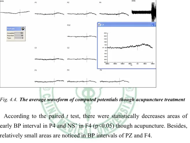 Fig. 4.4. The average waveform of computed potentials though acupuncture treatment 