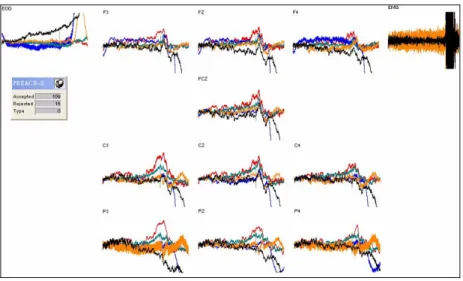 Fig. 4.5. All MRCPs before acupuncture in controls 