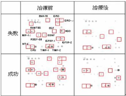 圖 2  以蛋白質晶片分析第二組病人。結果顯示，在治療前，成功大 於失敗的有 10 個，分別為 ENA-78、GRO、IL-8、RANTES、EGF、 Angiogenin、PDGF-BB、IGFBP-1、IGFBP-2 及 NT-4；成功小於失敗 的有 2 個，GRO-α 及 IL-1α。而在治療後 1 個月，治療成功下降，而 治療失敗不變或上升的有 MIP-1δ、RANTES、EGF、BDNF、NT-4、 Osteoprotegerin 及 TIMP-1；治療成功不變，而治療失敗在治療後會 上升的有 I