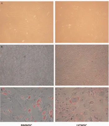 Figure  1.   Comparison  of   BMMSCs   and  UCMSCs.   (A)  In  vitro  culture,   BMMSCs and   UCMSCs showed    a   similar   spindle-shaped morphology  (1006)