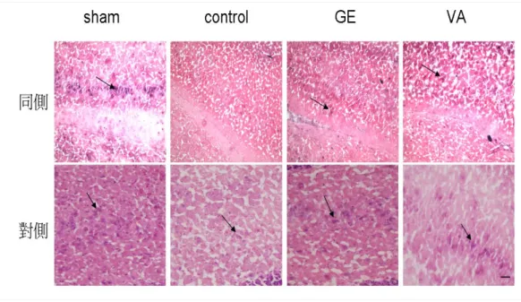 圖 4-2-1-3 天麻對 KA 誘發癲癇發作大鼠海馬 CA3 神經細胞的效 應:：在 400X 光學顯微鏡下，KA 注射之同側海馬 CA3 區神經細胞： 空白組（sham 同側）的細胞呈現圓形大顆紫色濃染核及淡紅色細胞 質，而 VA 組(VA 同側)及天麻組(GE 同側)可以看到圓大紫色濃染的 細胞核縮小，細胞質呈現深粉紅色（嗜伊紅性） ，而控制組(control 同 側)則幾乎看不到存活的細胞。在 KA 注射之對側海馬 CA3 區神經細 胞，則控空白組(sham 對側)、VA 組(VA 對側)和天麻組(