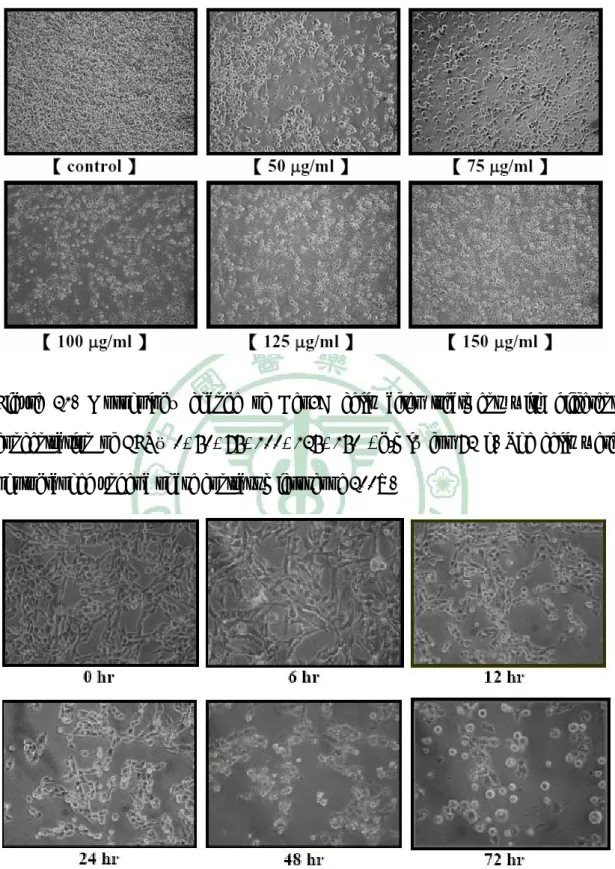 Figure 21. Morphology change of Hep3B cells after treatment with different  concentration of EFR（0, 50, 75, 100, 125, 150 μg/ml）for 72 h