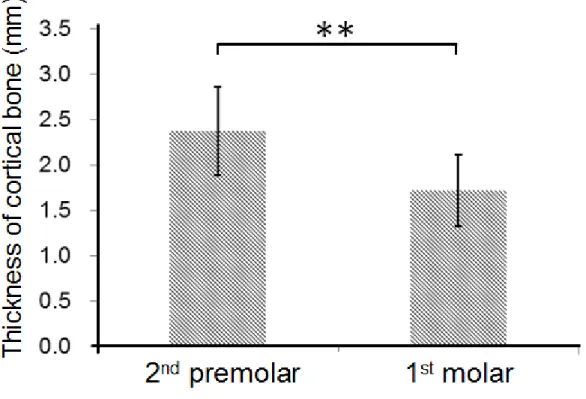Figure 3. The TC (thickness of the cortical bone at the occlusal side) at the second premolar and first molar position (**P < .001).