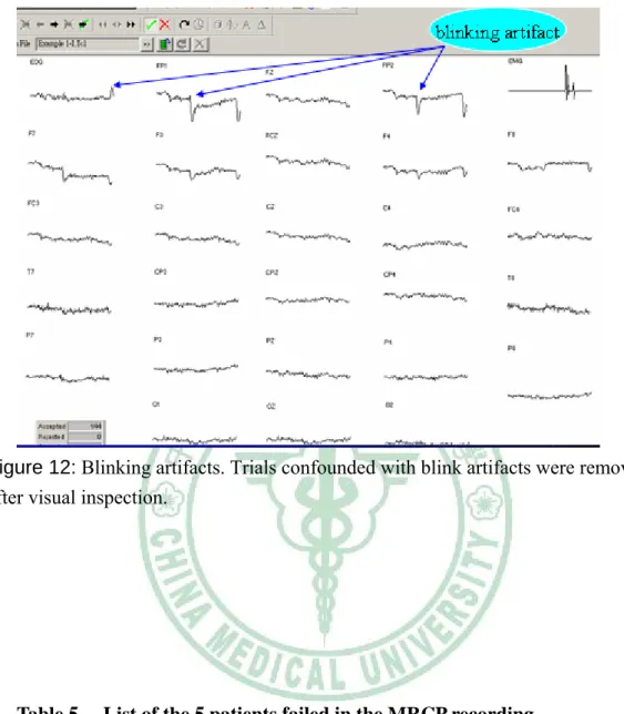 Figure 12: Blinking artifacts. Trials confounded with blink artifacts were removed  after visual inspection