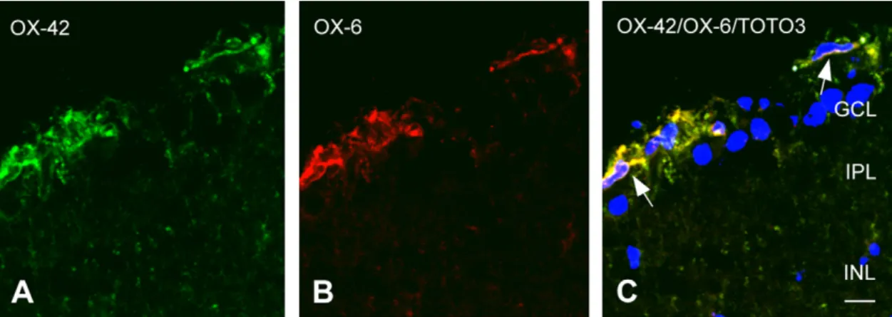 Fig. 5. Confocal images of retinal microglia/macrophages double-labeled with OX-42 (A) and OX-6 (B) at 3 days after kainate injection