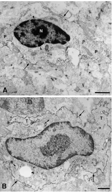 Fig. 7. Electron micrographs of degenerating neurons in the retinas at 1 (A) and 3 days (B) after kainate injection