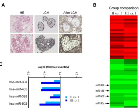 Figure 1. Decreased expression of miR-30a in breast tumors with lymph node  metastasis (LNM)