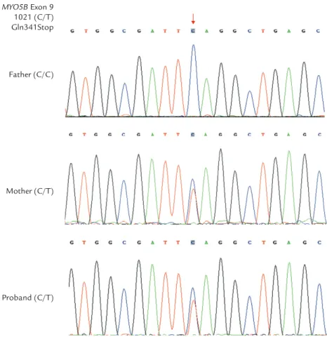 Figure 4. A heterozygous nonsense mutation (c.1021C > T, p.Q341X) in exon 9 of the MYO5B gene in the mother and proband.