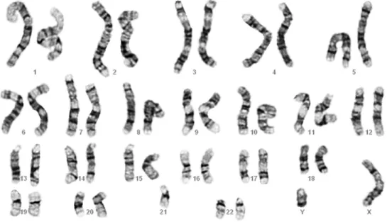 Fig. 4. A karyotype of 45,XY, e21.