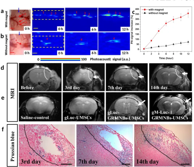 Figure 3. PA B-scan imaging and MRI imaging of Luc-GRMNBs-UMSCs in the hyperacute phase of a living stroke mouse brain