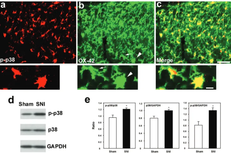 Fig. 2. p38 is activated in spinal microglia after spared nerve injury (SNI). (A–C) Double immunofluorescence shows phospho-p38 (p-p38)/OX-42 colocalization in the medial superficial dorsal horn 3 days after SNI