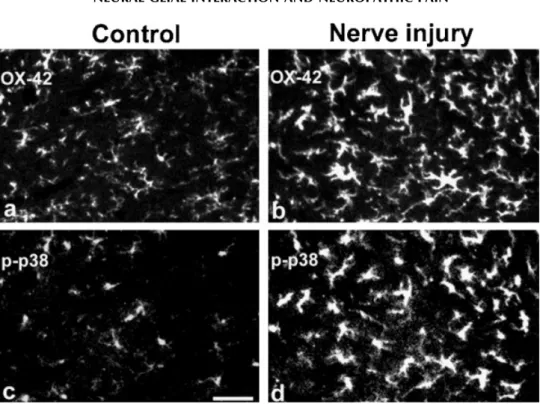 Fig. 1. a,b: Peripheral nerve injury by spinal nerve ligation induces a profound activation of microglia in the spinal cord dorsal horn, as indicated by increased expression of OX-42 (an antibody recognizing the microglial marker complement receptor-3 (CD-