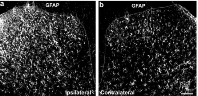 Fig. 2. a,b: Spinal nerve ligation produces a marked activation of astrocytes in the medial spinal cord dorsal horn, as indicated by increased expression of GFAP, an astroglial marker, as well as by distinct morphological changes of astroctytic processes f