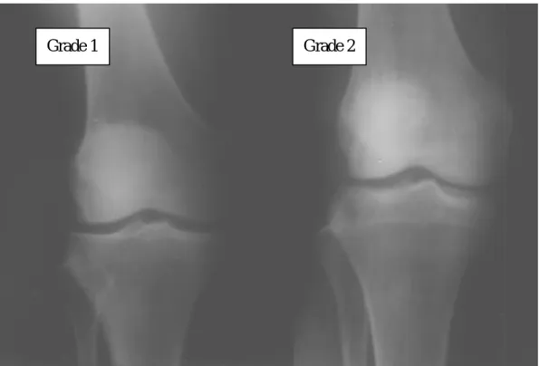 圖 2.4 K/L X-光攝影診斷標準 1,2 級 