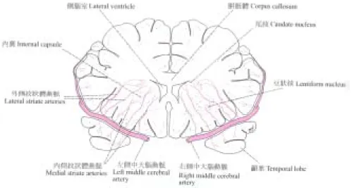 圖 2.4：大腦半球的冠狀切面，顯示中大腦動脈對大腦深部結構的動 脈供應情形[8]。 