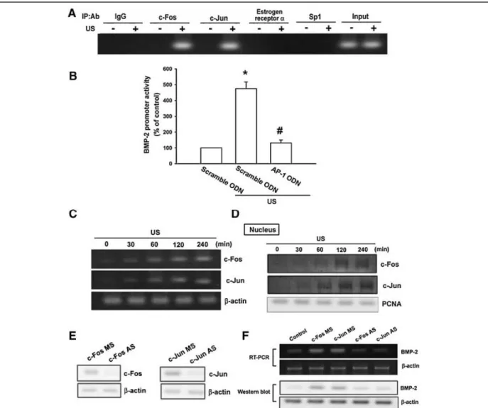 Fig. 5. AP-1 is involved in US-induced BMP-2 production. A: Osteoblasts were treated with US for the 20 min, and ChIP assay was  then  performed  120  min  following  US  stimulation
