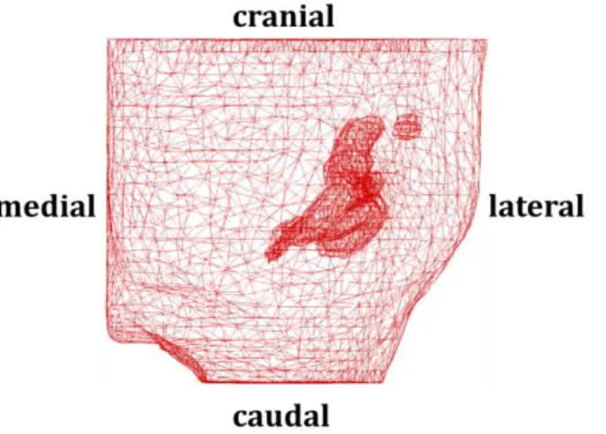 Fig.  4.  The volume mesh of  the  left  breast  and  the fibroglandular  tissues  generated  by  using the finite  element  software package MSC.Marc® 