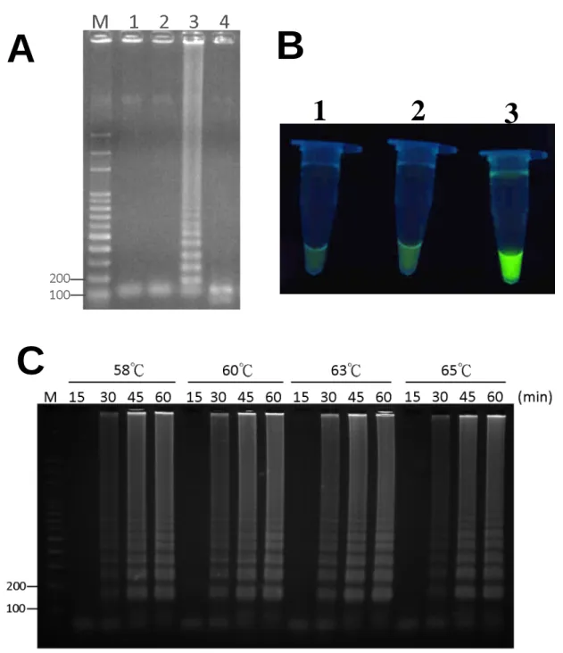 Figure 2. Analysis of the LAMP products using agarose gel electrophoresis and