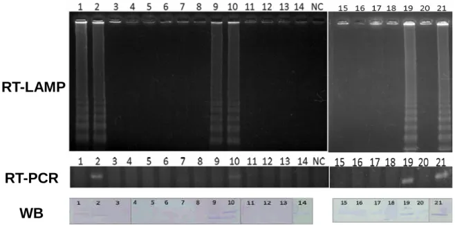 Figure 6. Detection of IBDV-RNA from experimental chickens by RT-LAMP. 1