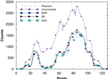 Fig. 3. Zubal phantom: the uncorrected image (a) and images corrected by SSS method (b), BS method with n ¼ 8 (c), and BSR method with n ¼ 8 (d)